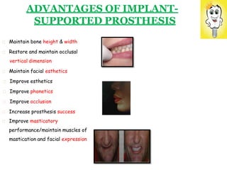 ADVANTAGES OF IMPLANT-
SUPPORTED PROSTHESIS
Maintain bone height & width
Restore and maintain occlusal
vertical dimension
Maintain facial esthetics
Improve esthetics
Improve phonetics
Improve occlusion
Increase prosthesis success
Improve masticatory
performance/maintain muscles of
mastication and facial expression
 