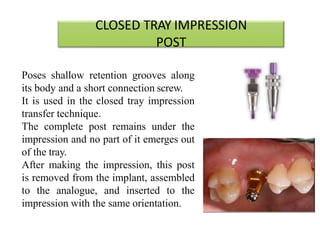 CLOSED TRAY IMPRESSION
POST
Poses shallow retention grooves along
its body and a short connection screw.
It is used in the closed tray impression
transfer technique.
The complete post remains under the
impression and no part of it emerges out
of the tray.
After making the impression, this post
is removed from the implant, assembled
to the analogue, and inserted to the
impression with the same orientation.
 