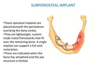 SUBPERIOSTEAL IMPLANT
•These epiosteal implants are
placed beneath the periosteum
overlying the bony cortex.
•They are lightweight, custom
made metal frameworks that fit
over the remaining bone. A single
implant can support a full arch
restoration.
•These are indicated when the
bone has atrophied and the jaw
structure is limited.
 