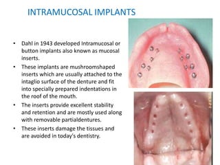 INTRAMUCOSAL IMPLANTS
• Dahl in 1943 developed Intramucosal or
button implants also known as mucosal
inserts.
• These implants are mushroomshaped
inserts which are usually attached to the
intaglio surface of the denture and fit
into specially prepared indentations in
the roof of the mouth.
• The inserts provide excellent stability
and retention and are mostly used along
with removable partialdentures.
• These inserts damage the tissues and
are avoided in today's dentistry.
 