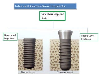 Intra oral Conventional Implants
Based on Implant
Level
Bone level
Implants
Tissue Level
Implants
 