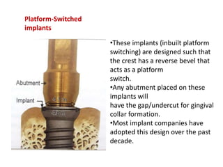Platform-Switched
implants
•These implants (inbuilt platform
switching) are designed such that
the crest has a reverse bevel that
acts as a platform
switch.
•Any abutment placed on these
implants will
have the gap/undercut for gingival
collar formation.
•Most implant companies have
adopted this design over the past
decade.
 
