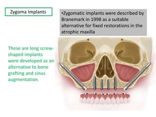 Zygoma Implants •Zygomatic implants were described by
Branemark in 1998 as a suitable
alternative for fixed restorations in the
atrophic maxilla
These are long screw-
shaped implants
were developed as an
alternative to bone
grafting and sinus
augmentation.
 