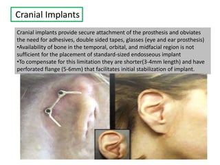 Cranial Implants
Cranial implants provide secure attachment of the prosthesis and obviates
the need for adhesives, double sided tapes, glasses (eye and ear prosthesis)
•Availability of bone in the temporal, orbital, and midfacial region is not
sufficient for the placement of standard-sized endosseous implant
•To compensate for this limitation they are shorter(3-4mm length) and have
perforated flange (5-6mm) that facilitates initial stabilization of implant.
 