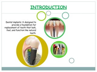 INTRODUCTION
Dental implants  designed to
provide a foundation for
replacement of teeth that look,
feel, and function like natural
teeth.
 