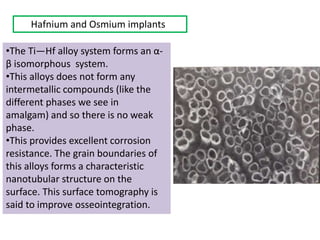 Hafnium and Osmium implants
•The Ti—Hf alloy system forms an α-
β isomorphous system.
•This alloys does not form any
intermetallic compounds (like the
different phases we see in
amalgam) and so there is no weak
phase.
•This provides excellent corrosion
resistance. The grain boundaries of
this alloys forms a characteristic
nanotubular structure on the
surface. This surface tomography is
said to improve osseointegration.
 