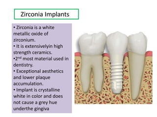 Zirconia Implants
• Zirconia is a white
metallic oxide of
zirconium.
• It is extensivelyin high
strength ceramics.
•2nd most material used in
dentistry.
• Exceptional aesthetics
and lower plaque
accumulation.
• Implant is crystalline
white in color and does
not cause a grey hue
underthe gingiva
 
