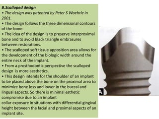 B.Scalloped design
• The design was patented by Peter S Woehrle in
2001.
• The design follows the three dimensional contours
of the bone.
• The idea of the design is to preserve interproximal
bone and to avoid black triangle embrasures
between restorations.
• The scalloped soft tissue apposition area allows for
the development of the biologic width around the
entire neck of the implant.
• From a prosthodontic perspective the scalloped
design is more aesthetics.
• This design intends for the shoulder of an implant
to be placed above the bone on the proximal area to
minimize bone loss and lower in the buccal and
lingual aspects. So there is minimal esthetic
compromise due to an implant
collar exposure in situations with differential gingival
height between the facial and proximal aspects of an
implant site.
 