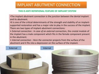 IMPLANT ABUTMENT CONNECTION
•The implant abutment connection is the junction between the dental implant
and its abutment.
•It is one of the critical determinants of the strength and stability of an implant-
supported restoration and has a major role to play in the success of the implant.
There are two types of implant-abutment connections:
• External connection : In case of an external connection, the crestal module of
the implant has a male component which fits in the female component present
in the abutment.
• Internal connection : Here the connector projects from the surface of the
abutment and it fits into a depression on the surface of the implant.
External Internal
THIS IS ANTI ROTATIONAL FEATURE OF IMPLANT SYSTEM
 