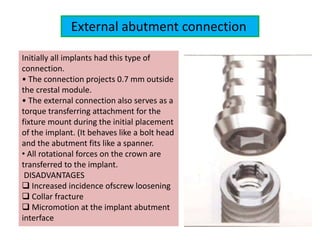 External abutment connection
Initially all implants had this type of
connection.
• The connection projects 0.7 mm outside
the crestal module.
• The external connection also serves as a
torque transferring attachment for the
fixture mount during the initial placement
of the implant. (It behaves like a bolt head
and the abutment fits like a spanner.
• All rotational forces on the crown are
transferred to the implant.
DISADVANTAGES
 Increased incidence ofscrew loosening
 Collar fracture
 Micromotion at the implant abutment
interface
 