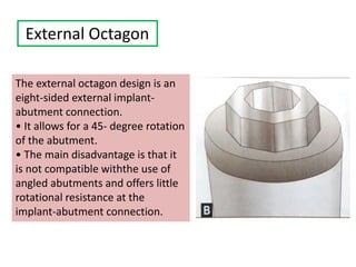 External Octagon
The external octagon design is an
eight-sided external implant-
abutment connection.
• It allows for a 45- degree rotation
of the abutment.
• The main disadvantage is that it
is not compatible withthe use of
angled abutments and offers little
rotational resistance at the
implant-abutment connection.
 