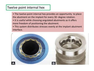 Twelve point internal hex
• The twelve-point internal hex provides an opportunity to place
the abutment on the implant for every 30- degree rotation.
• It is useful while choosing angulated abutments as it offers
more freedom of positioning the abutment.
• This system distributes stresses evenly at the implant abutment
interface.
 