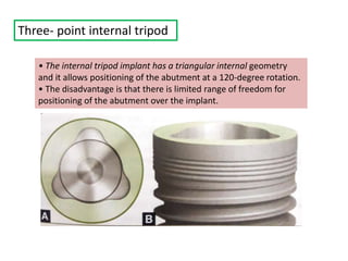 Three- point internal tripod
• The internal tripod implant has a triangular internal geometry
and it allows positioning of the abutment at a 120-degree rotation.
• The disadvantage is that there is limited range of freedom for
positioning of the abutment over the implant.
 