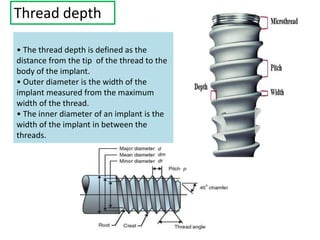 • The thread depth is defined as the
distance from the tip of the thread to the
body of the implant.
• Outer diameter is the width of the
implant measured from the maximum
width of the thread.
• The inner diameter of an implant is the
width of the implant in between the
threads.
Thread depth
 