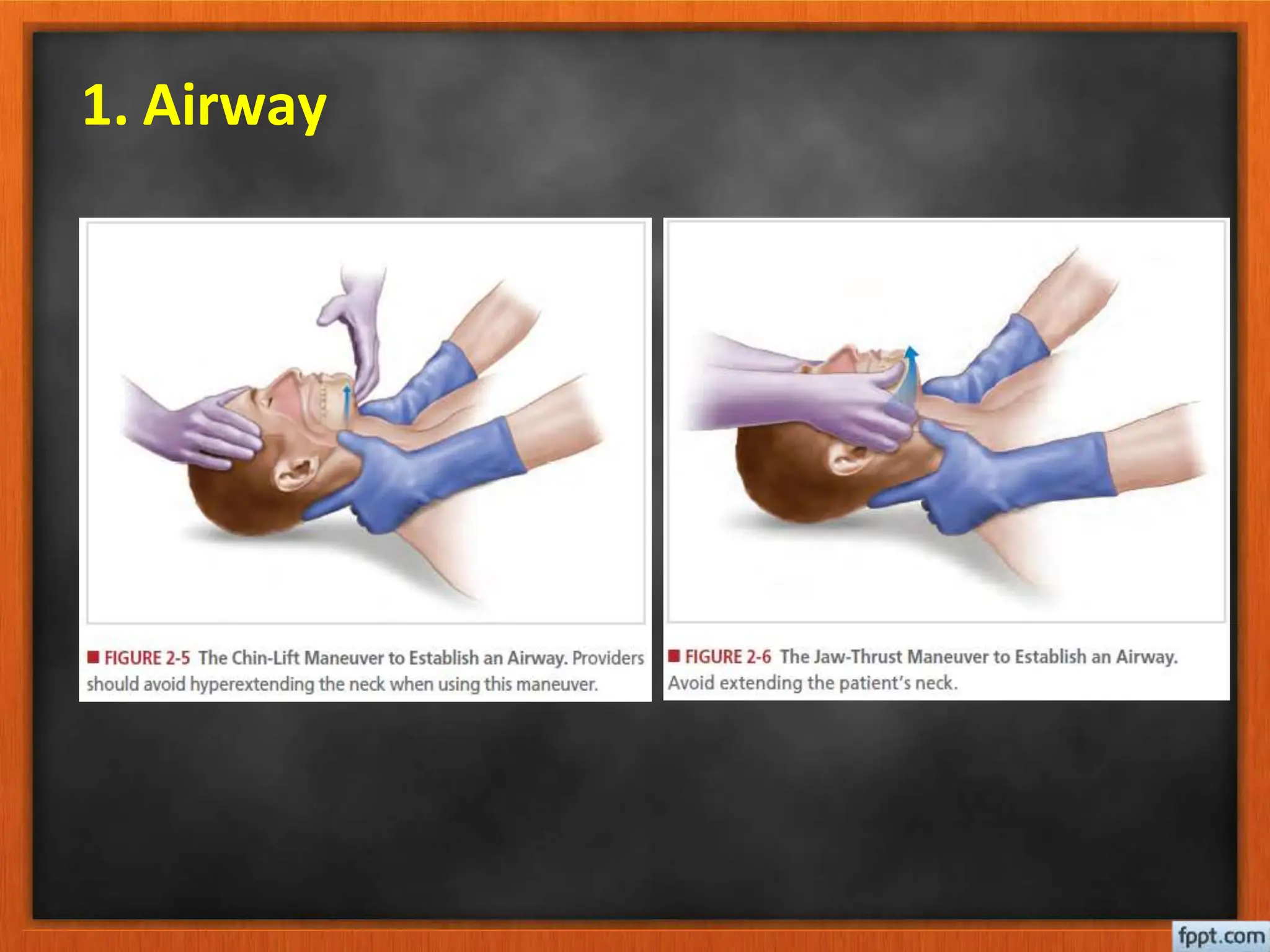 BASIC ATLS principle, management and therapy.pptx