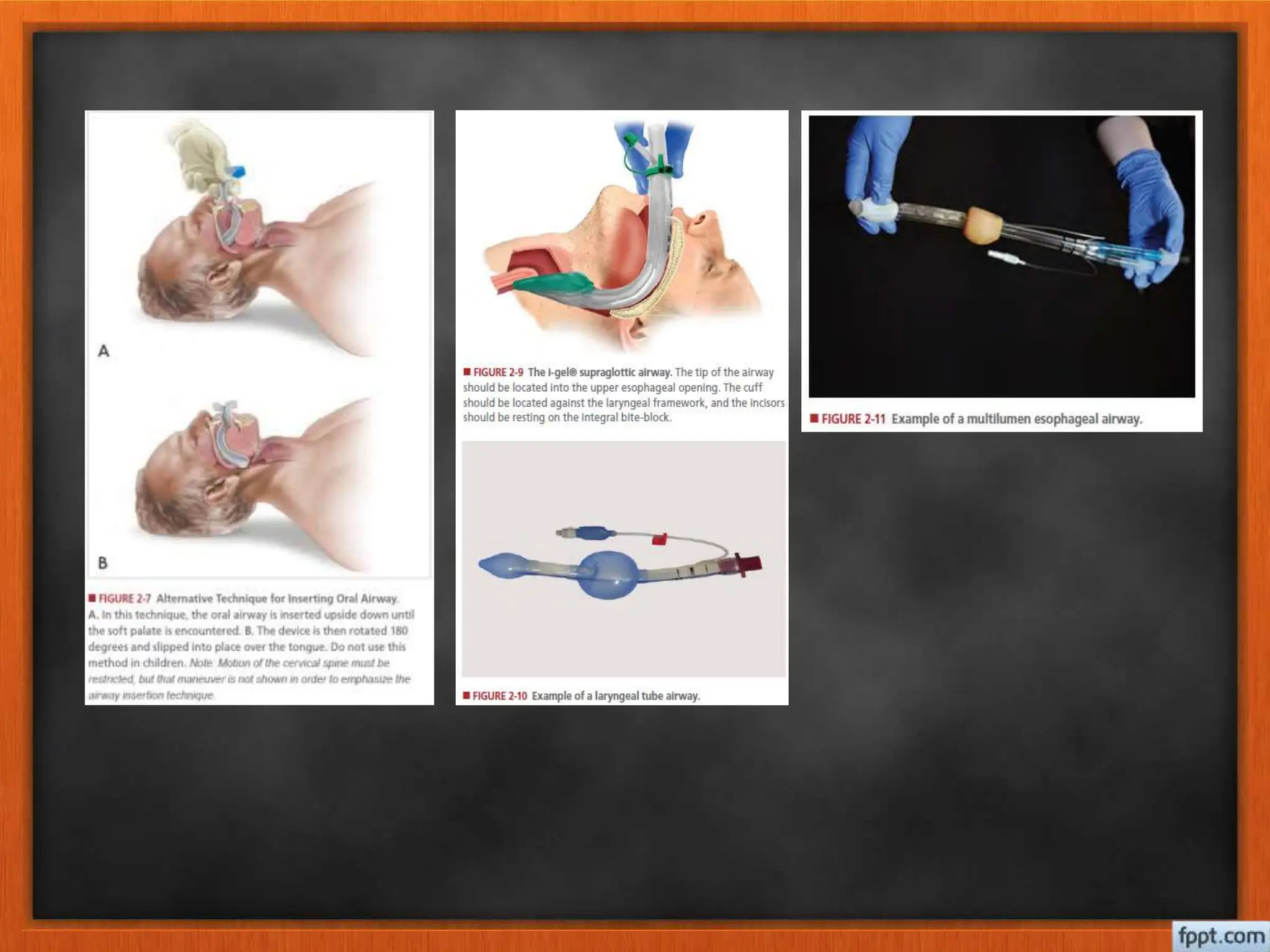 BASIC ATLS principle, management and therapy.pptx