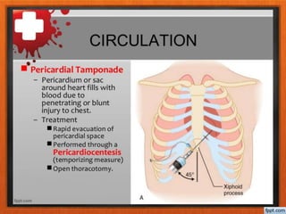 BASIC ATLS principle, management and therapy.pptx