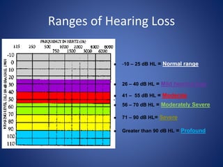 Pure Tone Audiometry | PPTX | Digital Audio | Computer Software and ...