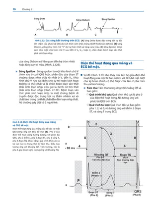 Basic Bedside Electrocardiography (Tiếng Việt).pdf