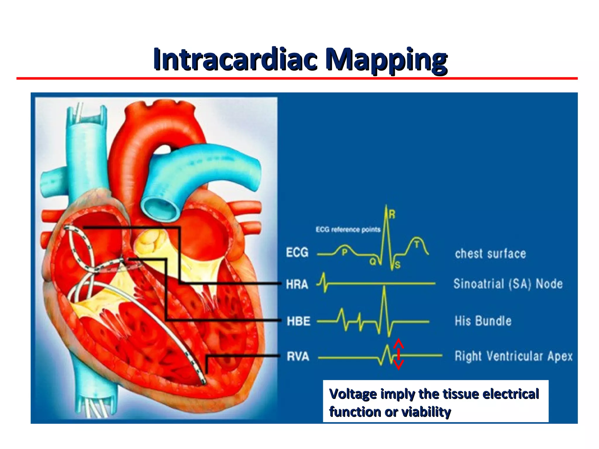 Basic Cardiac Electrophysiology and ECG Concepts_20120902_北區 | PPT