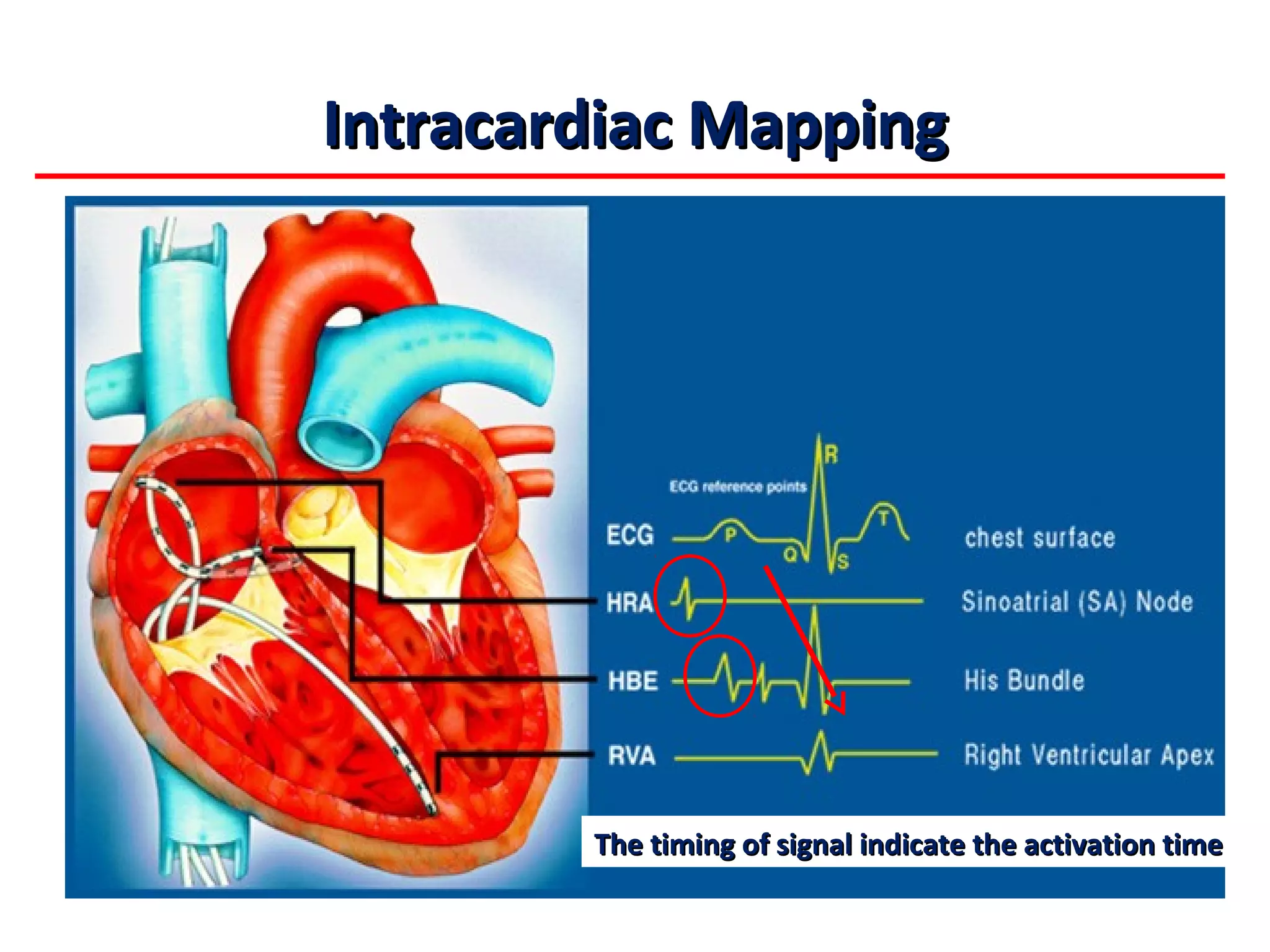 Basic Cardiac Electrophysiology and ECG Concepts_20120902_北區 | PPT
