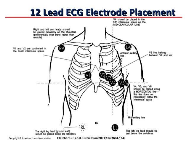 Basic Cardiac Electrophysiology and ECG Concepts_20120902_北區