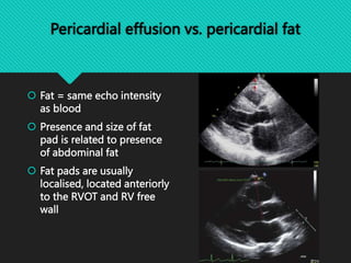 BASIC CARDIAC US.pptx