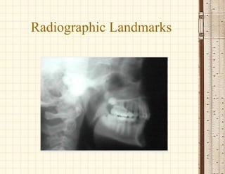 Radiographic Landmarks
 