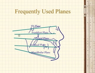 SN Plane
Frankfort Plane
Palatal Plane
Occlusal Plane
Mandibular Plane
Frequently Used Planes
 