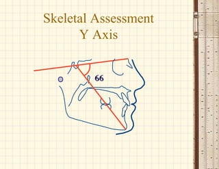 6666
Skeletal Assessment
Y Axis
 