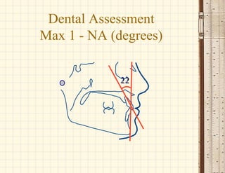 2222
Dental Assessment
Max 1 - NA (degrees)
 
