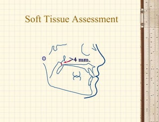 >4 mm.>4 mm.
Soft Tissue Assessment
 
