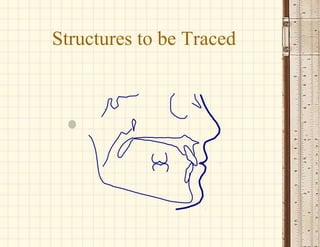 Structures to be Traced
 