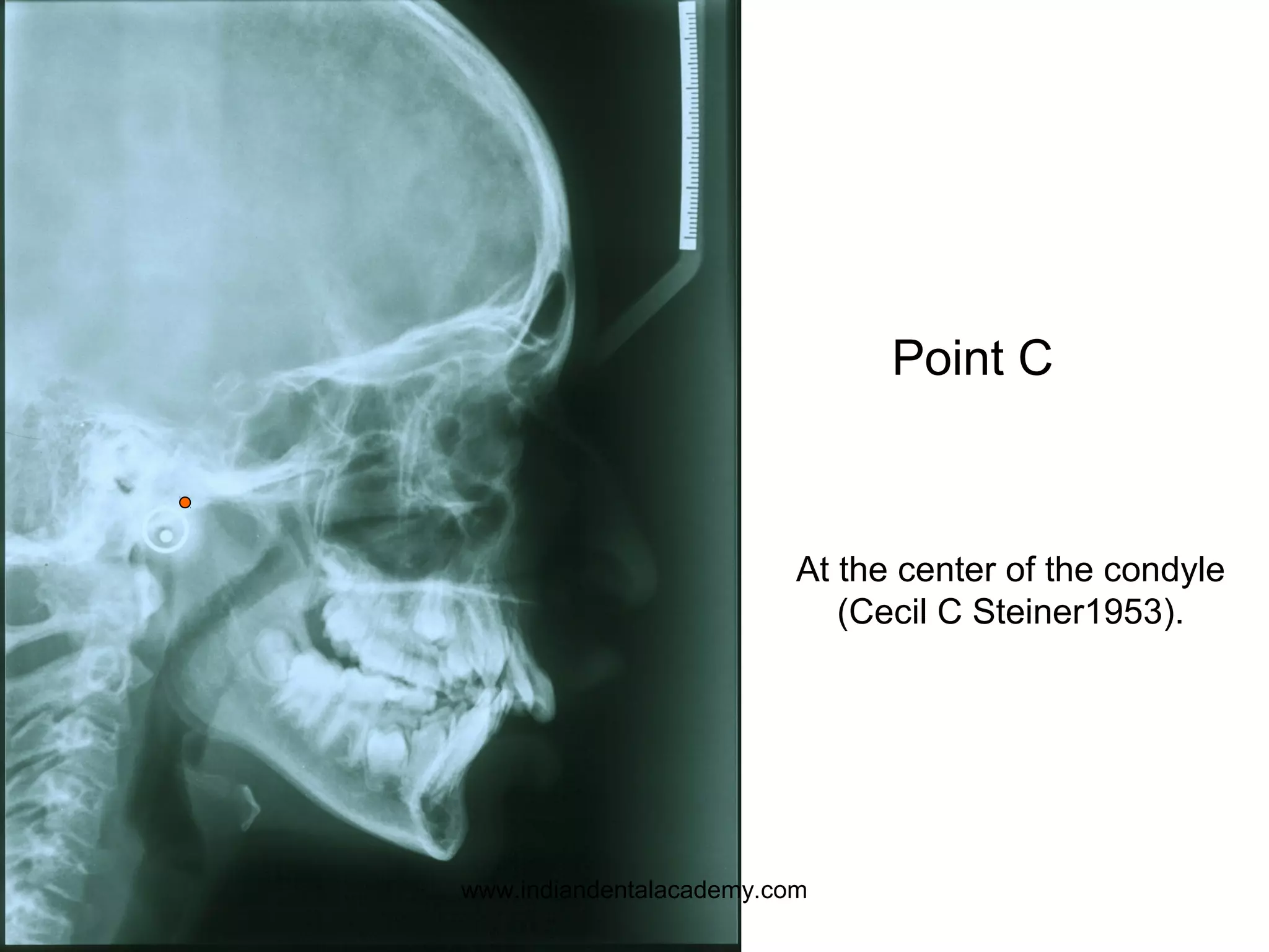 Point C
At the center of the condyle
(Cecil C Steiner1953).
www.indiandentalacademy.com
 