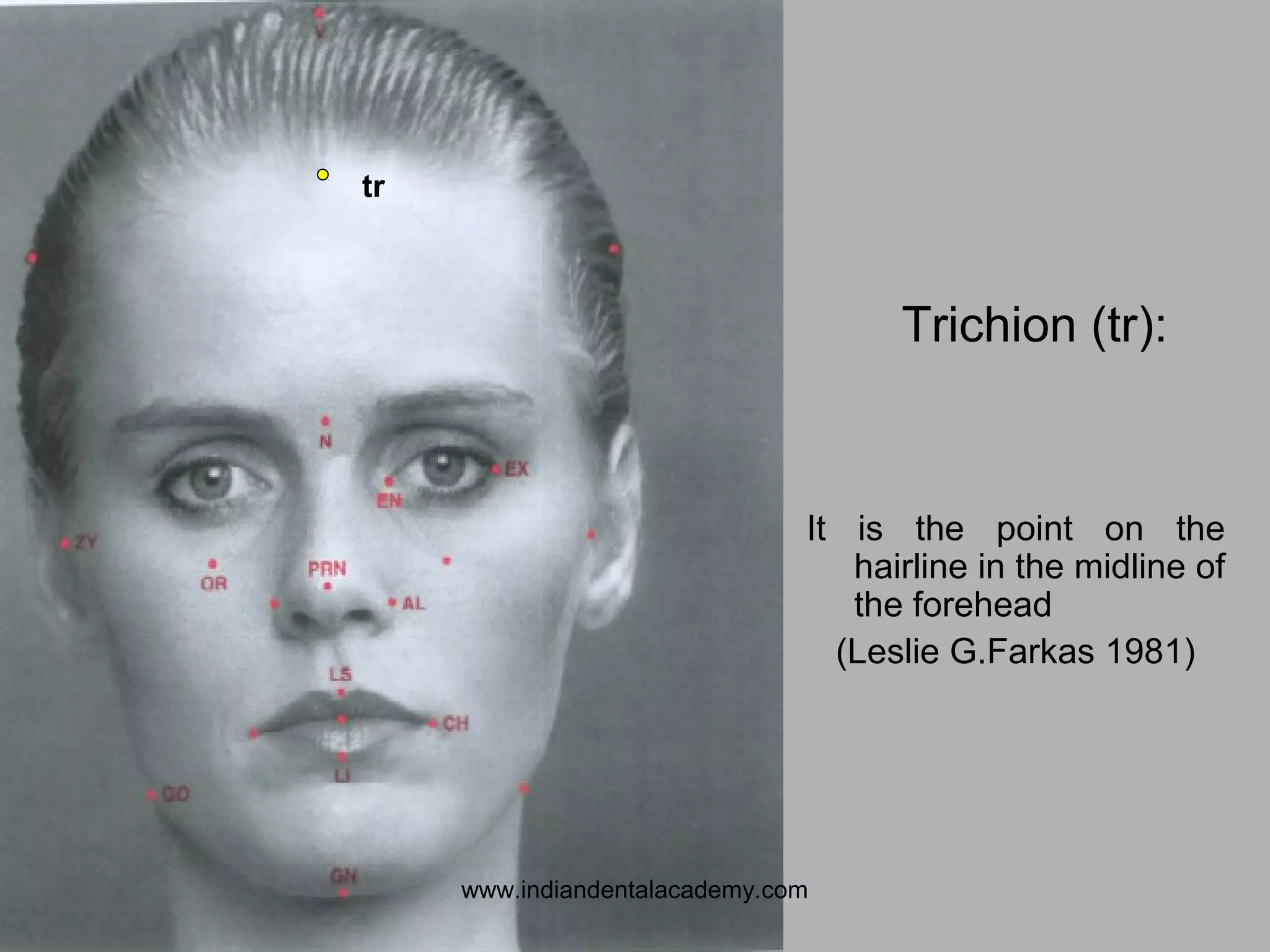 It is the point on the
hairline in the midline of
the forehead
(Leslie G.Farkas 1981)
Trichion (tr):
tr
www.indiandentalacademy.com
 