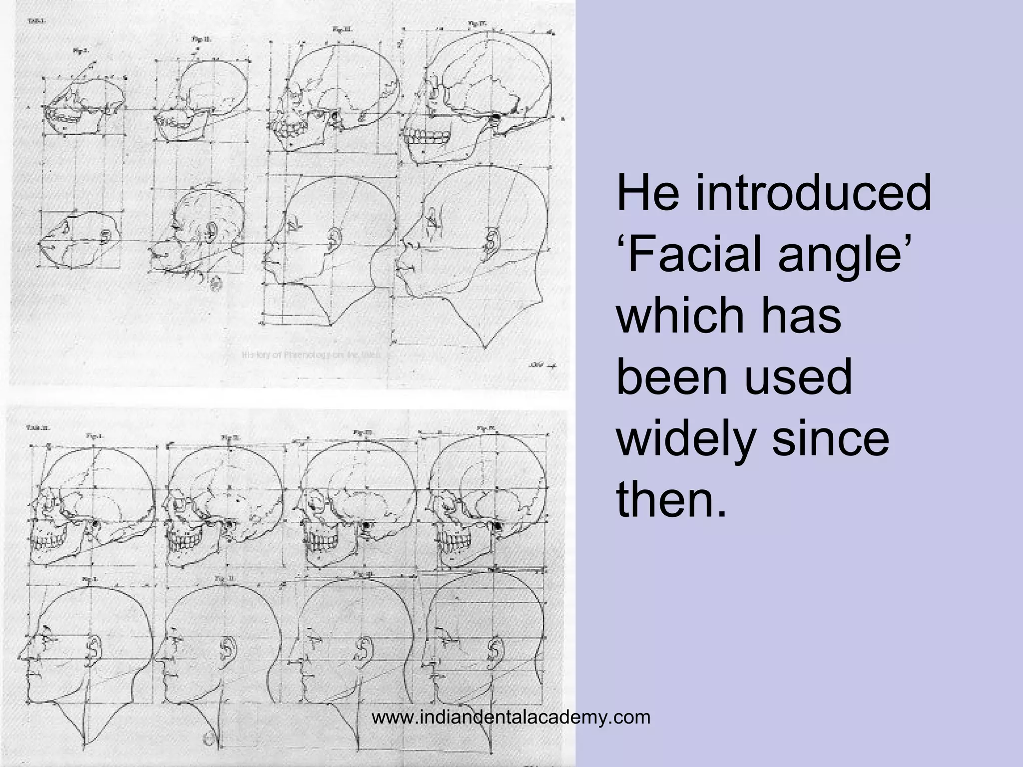 He introduced
‘Facial angle’
which has
been used
widely since
then.
www.indiandentalacademy.com
 