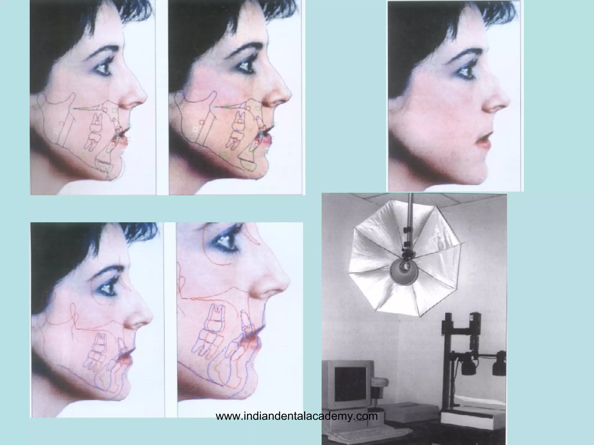 www.indiandentalacademy.com
 