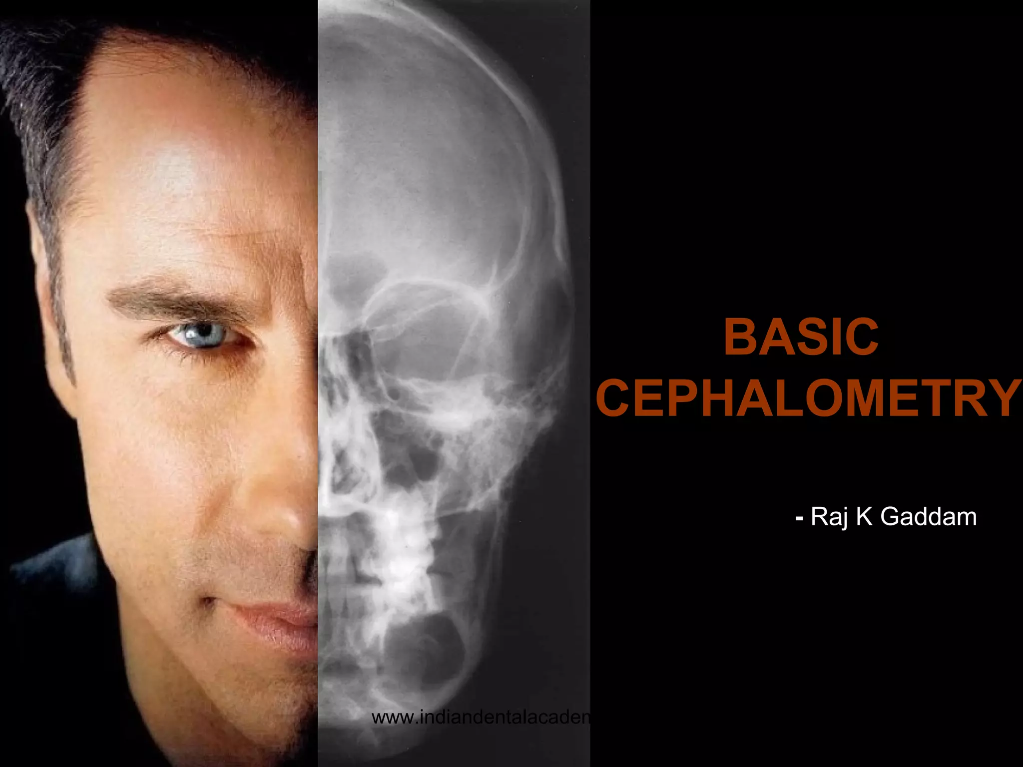 BASIC
CEPHALOMETRY
- Raj K Gaddam
www.indiandentalacademy.com
 
