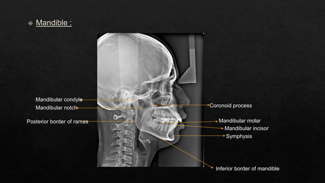 BASIC CEPHALOMETRY.pptx