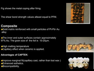 Fig shows the metal coping after firing.
The shear bond strength values atleast equal to PFM.
Composite
Gold matrix reinforced with small particles of Pt-Pd- Au
alloy
The inner and outer surfaces contain approximately
97% Au. The grain size of the foil is 15-20µm.
High melting temperature
Capillary effect when ceramic is applied.
Advantages of CAPTEK:
Improve marginal fit(capillary cast, rather than lost wax )
Enhanced esthetics.
Biocompatibility.
 