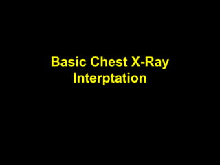 Basic Chest X-Ray
Interptation
 