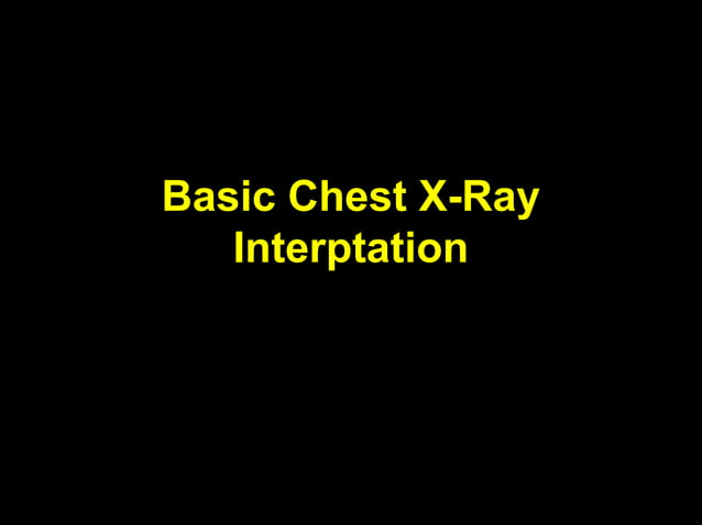 Basic chest x ray interpretation | PPT