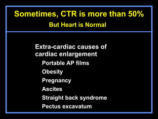Basic chest x ray interpretation | PPT