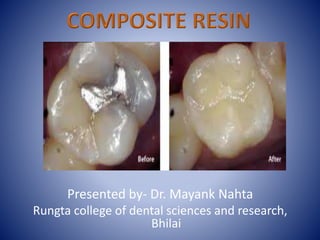 Presented by- Dr. Mayank Nahta
Rungta college of dental sciences and research,
Bhilai
 
