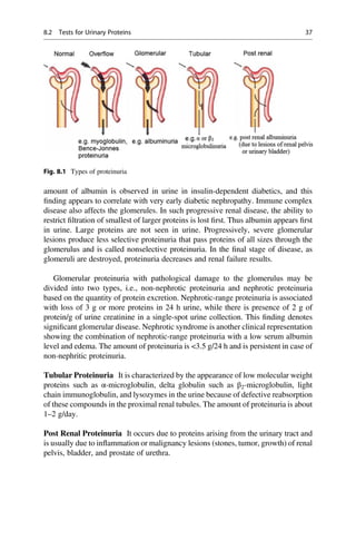 amount of albumin is observed in urine in insulin-dependent diabetics, and this
ﬁnding appears to correlate with very early diabetic nephropathy. Immune complex
disease also affects the glomerules. In such progressive renal disease, the ability to
restrict ﬁltration of smallest of larger proteins is lost ﬁrst. Thus albumin appears ﬁrst
in urine. Large proteins are not seen in urine. Progressively, severe glomerular
lesions produce less selective proteinuria that pass proteins of all sizes through the
glomerulus and is called nonselective proteinuria. In the ﬁnal stage of disease, as
glomeruli are destroyed, proteinuria decreases and renal failure results.
Glomerular proteinuria with pathological damage to the glomerulus may be
divided into two types, i.e., non-nephrotic proteinuria and nephrotic proteinuria
based on the quantity of protein excretion. Nephrotic-range proteinuria is associated
with loss of 3 g or more proteins in 24 h urine, while there is presence of 2 g of
protein/g of urine creatinine in a single-spot urine collection. This ﬁnding denotes
signiﬁcant glomerular disease. Nephrotic syndrome is another clinical representation
showing the combination of nephrotic-range proteinuria with a low serum albumin
level and edema. The amount of proteinuria is 3.5 g/24 h and is persistent in case of
non-nephritic proteinuria.
Tubular Proteinuria It is characterized by the appearance of low molecular weight
proteins such as α-microglobulin, delta globulin such as β2-microglobulin, light
chain immunoglobulin, and lysozymes in the urine because of defective reabsorption
of these compounds in the proximal renal tubules. The amount of proteinuria is about
1–2 g/day.
Post Renal Proteinuria It occurs due to proteins arising from the urinary tract and
is usually due to inﬂammation or malignancy lesions (stones, tumor, growth) of renal
pelvis, bladder, and prostate of urethra.
Fig. 8.1 Types of proteinuria
8.2 Tests for Urinary Proteins 37
 