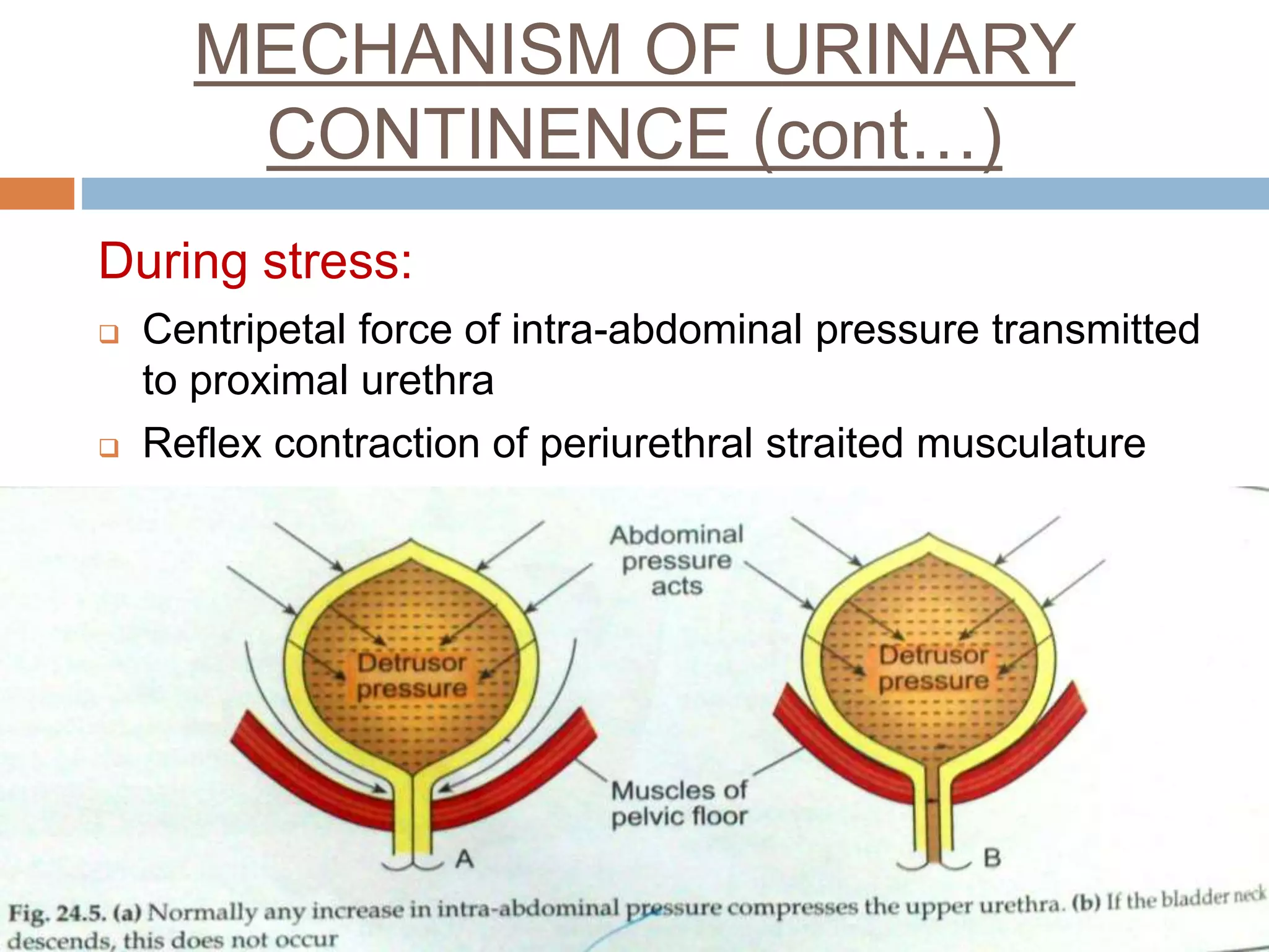 MECHANISM OF URINARY
CONTINENCE (cont…)
During stress:
 Centripetal force of intra-abdominal pressure transmitted
to proximal urethra
 Reflex contraction of periurethral straited musculature
 