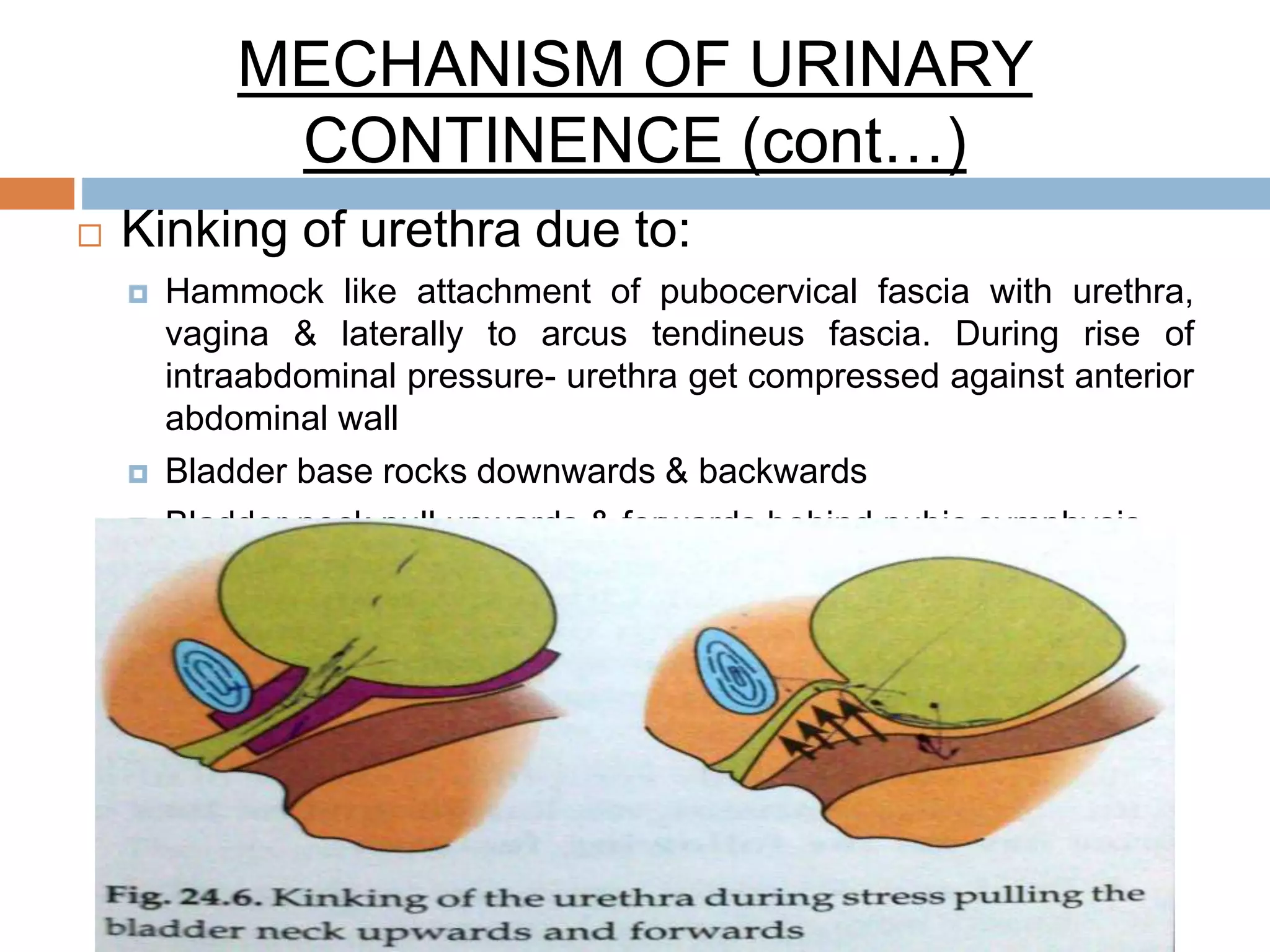 MECHANISM OF URINARY
CONTINENCE (cont…)
 Kinking of urethra due to:
 Hammock like attachment of pubocervical fascia with urethra,
vagina & laterally to arcus tendineus fascia. During rise of
intraabdominal pressure- urethra get compressed against anterior
abdominal wall
 Bladder base rocks downwards & backwards
 Bladder neck pull upwards & forwards behind pubic symphysis
 