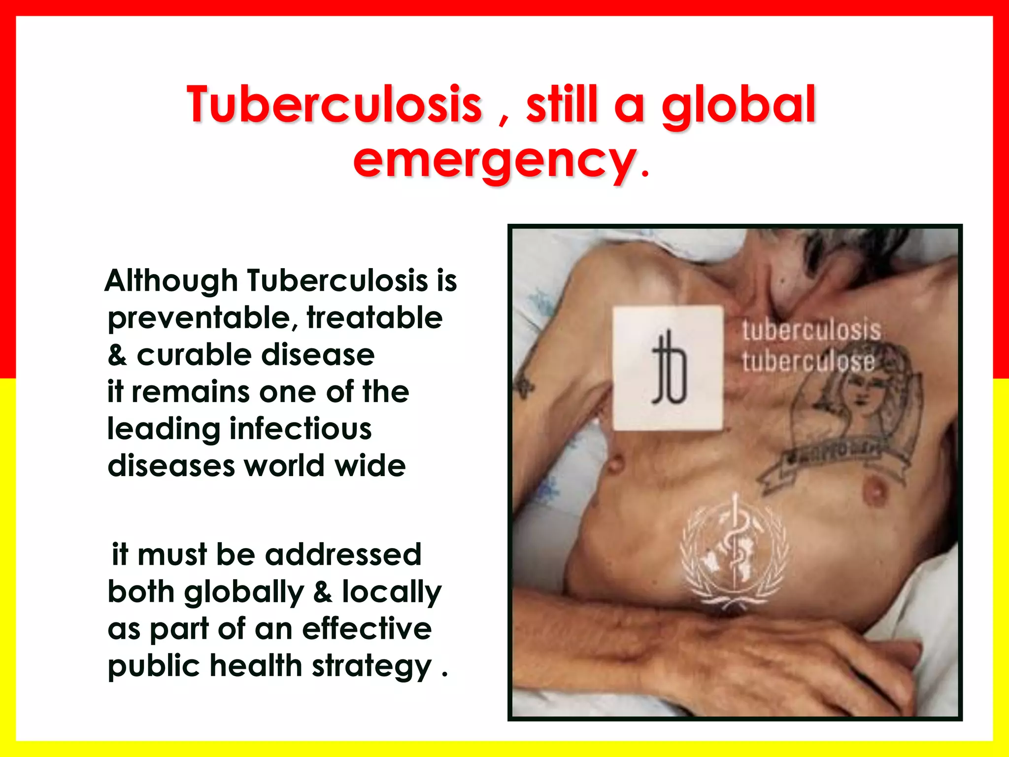 Tuberculosis , still a global emergency. 
Although Tuberculosis is preventable, treatable & curable disease it remains one of the leading infectious diseases world wide 
it must be addressed both globally & locally as part of an effective public health strategy .  