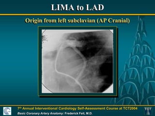 Lima Dissection Basic Coronary Anatomy - Paul Fefer, MD..ppt