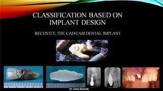 Basic dental implant